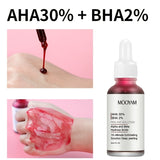 AHA 30% + BHA 2% Peeling Solutions, 30% AHA Glycolic Acid Peel With Lactic Acid Aloe Vera, Facial Exfoliator Exfoliating Peel Serum For Pimple Spot 1 Fl Oz