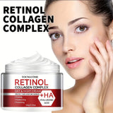 Retinol & Collagen Hydrating Cream - 60g | Deep Moisture for Dry, Rough Skin | Makes Skin Silky & Radiant | Hypoallergenic with Glycerin, Vitamin E & Hyaluronic Acid